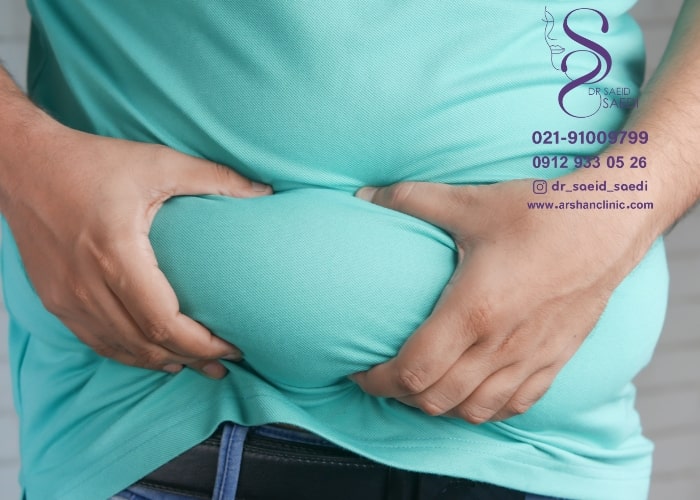 استخراج چربی از بدن