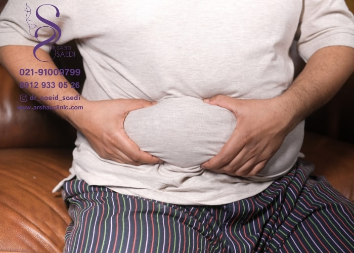چگونه لاغر شویم