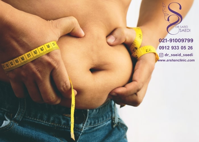 استخراج چربی از بدن