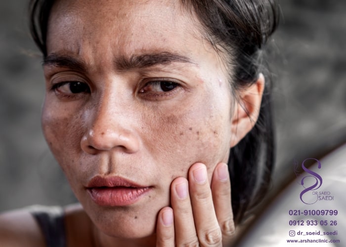 نکروز