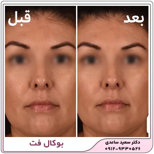 نمونه کار بوکال فت