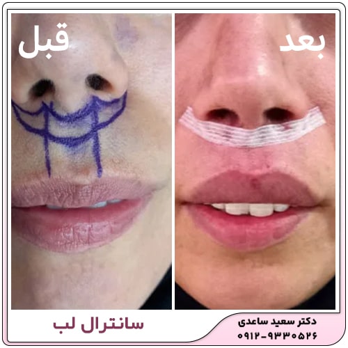 نمونه کار سانترال لب