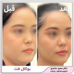 بوکال فت