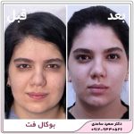 بوکال فت