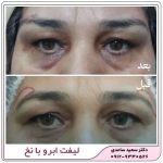 لیفت ابرو با نخ