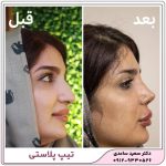 تیپ پلاستی