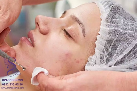 پاکسازی
