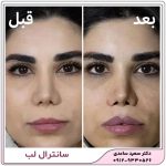 سانترال لب