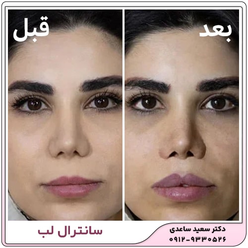 نمونه کار سانترال لب