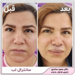 سانترال لب