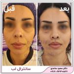 سانترال لب
