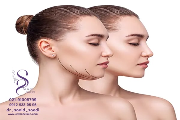 استحمام و خواب بعد از ساکشن غبغب چگونه است؟