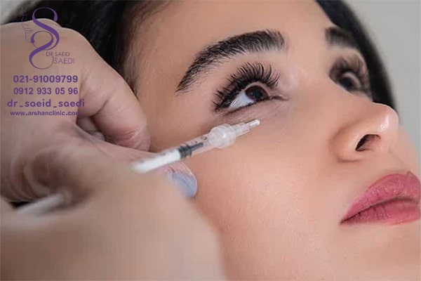 مزوتراپی زیر چشم