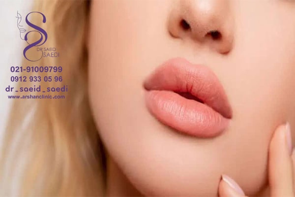 نحوه از بین بردن ورم بعد از سانترال لب