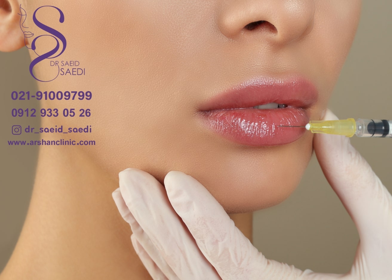 مقایسه هزینه فیلر لب با ژل لب