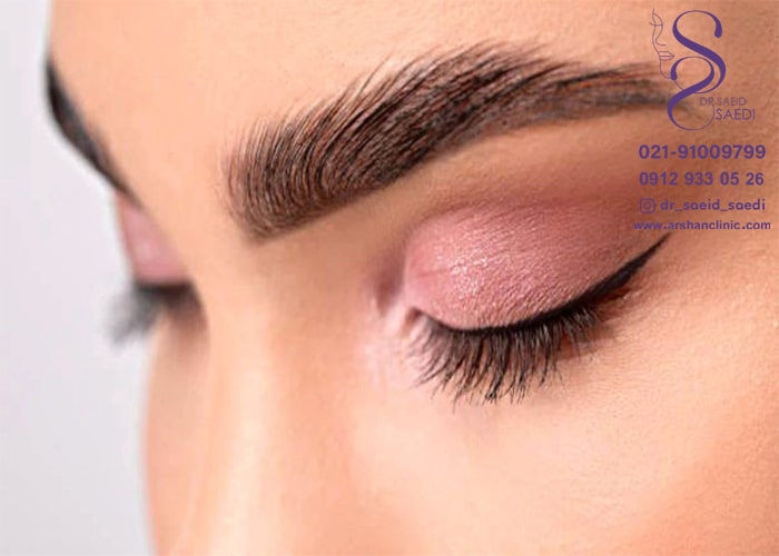 تراکم فولیکول های پیوندی