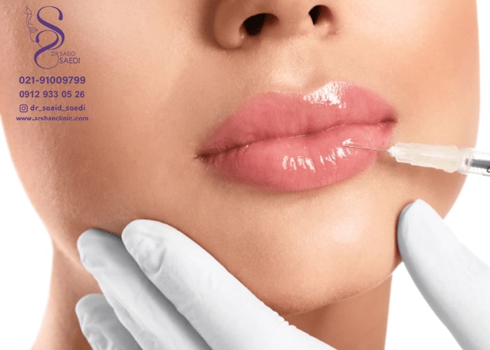 تخلیه ژل تزریق شده از طریق سوزن