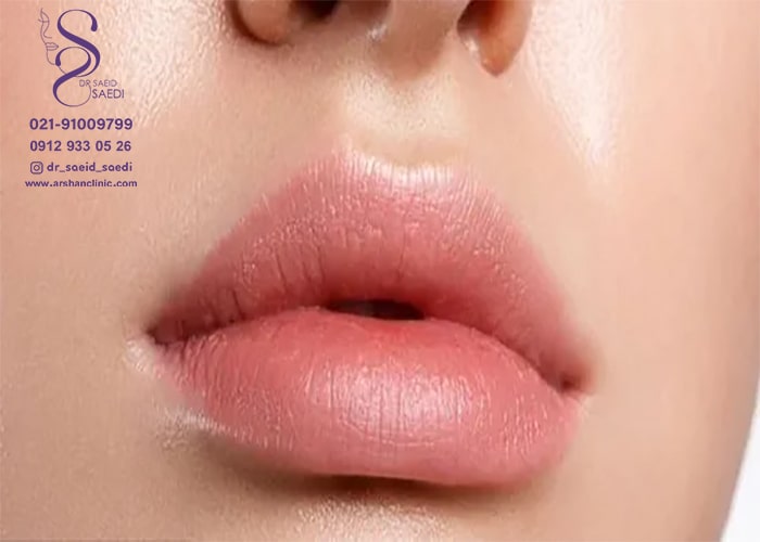 تخلیه ژل تزریق شده از طریق لیزر