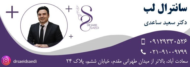 سانترال لب