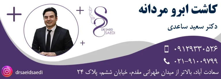 کاشت ابرو مردانه